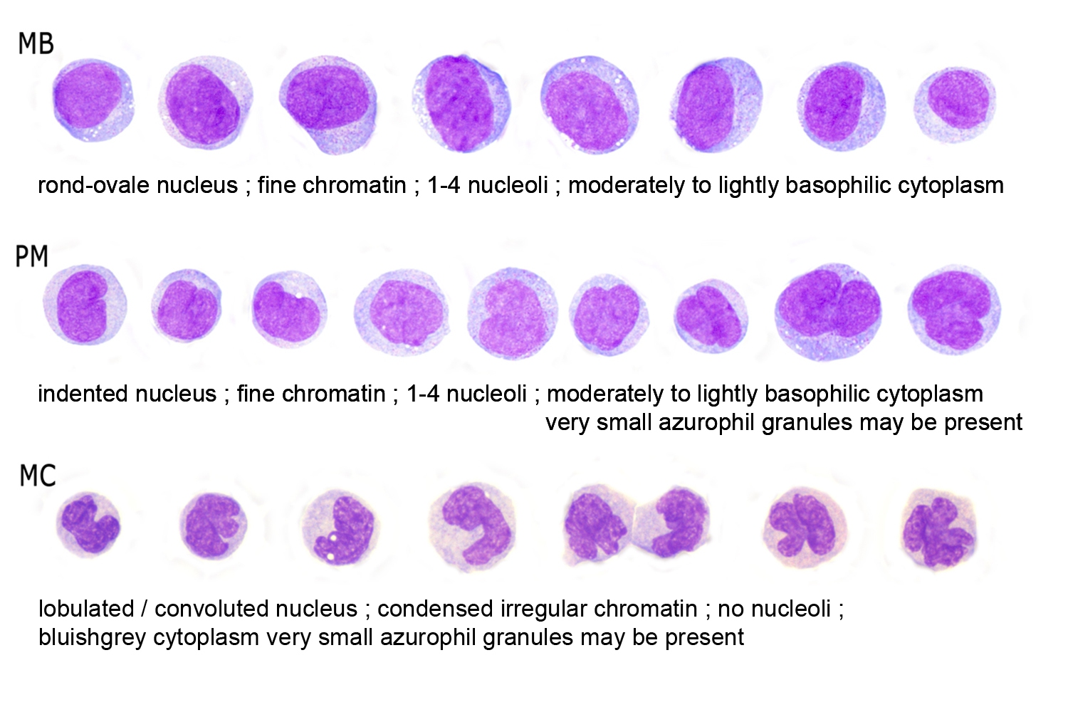 Monocytes Hematomorphology A Databank Imagebank For Hematology 