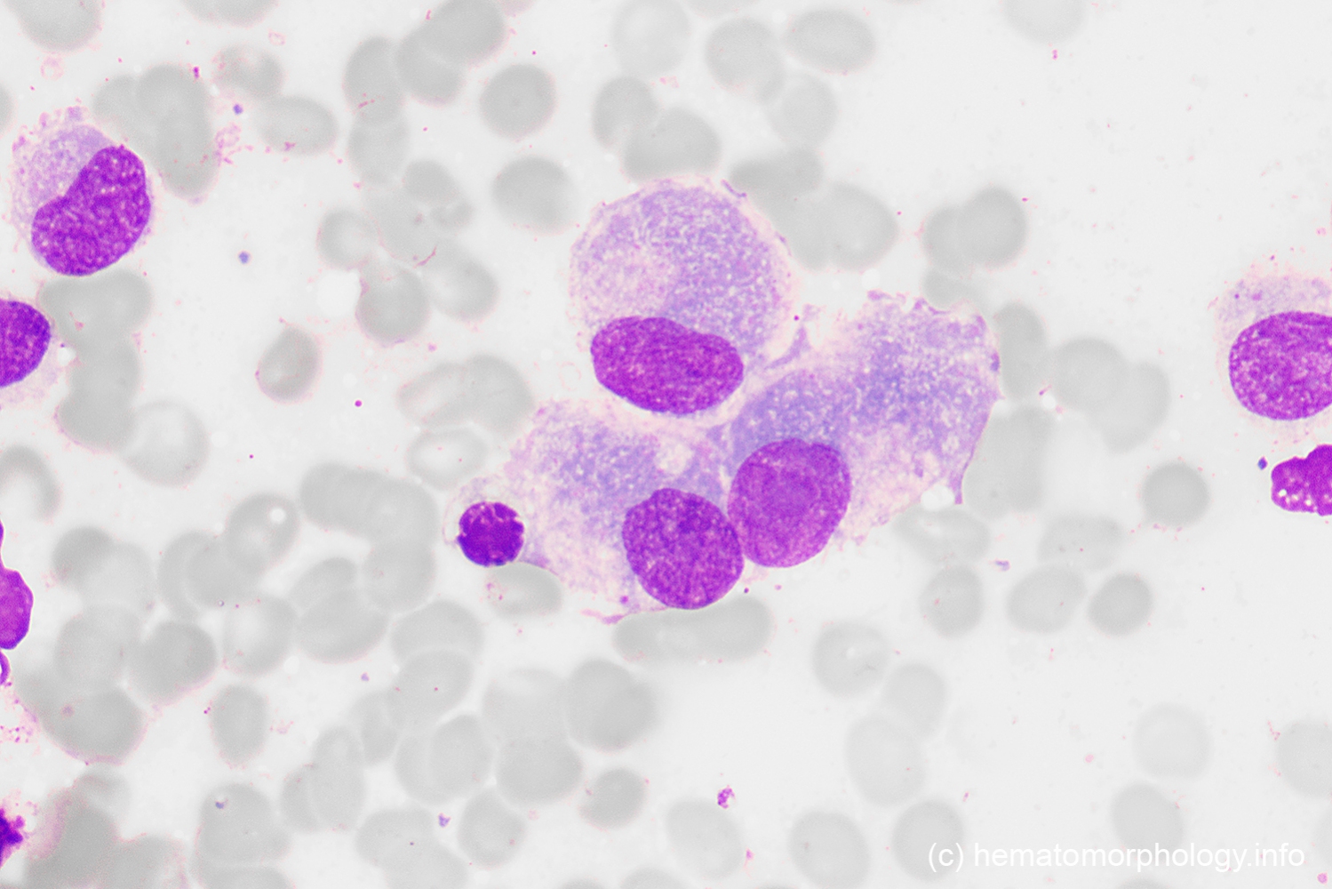 Osteoclasts Osteoblasts Hematomorphology A Databank Imagebank