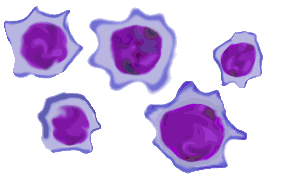 Lymphocytes - Hematomorphology, a databank / imagebank for hematology ...